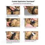 BCB Combat Tourniquet Negru - Negru » Lanternaputernica.RO
